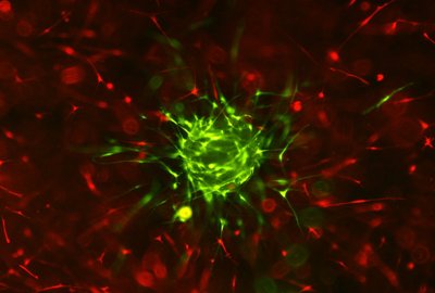 Индуцированные полипотентные стволовые клетки кожи человека. Фото Ольги Роговой